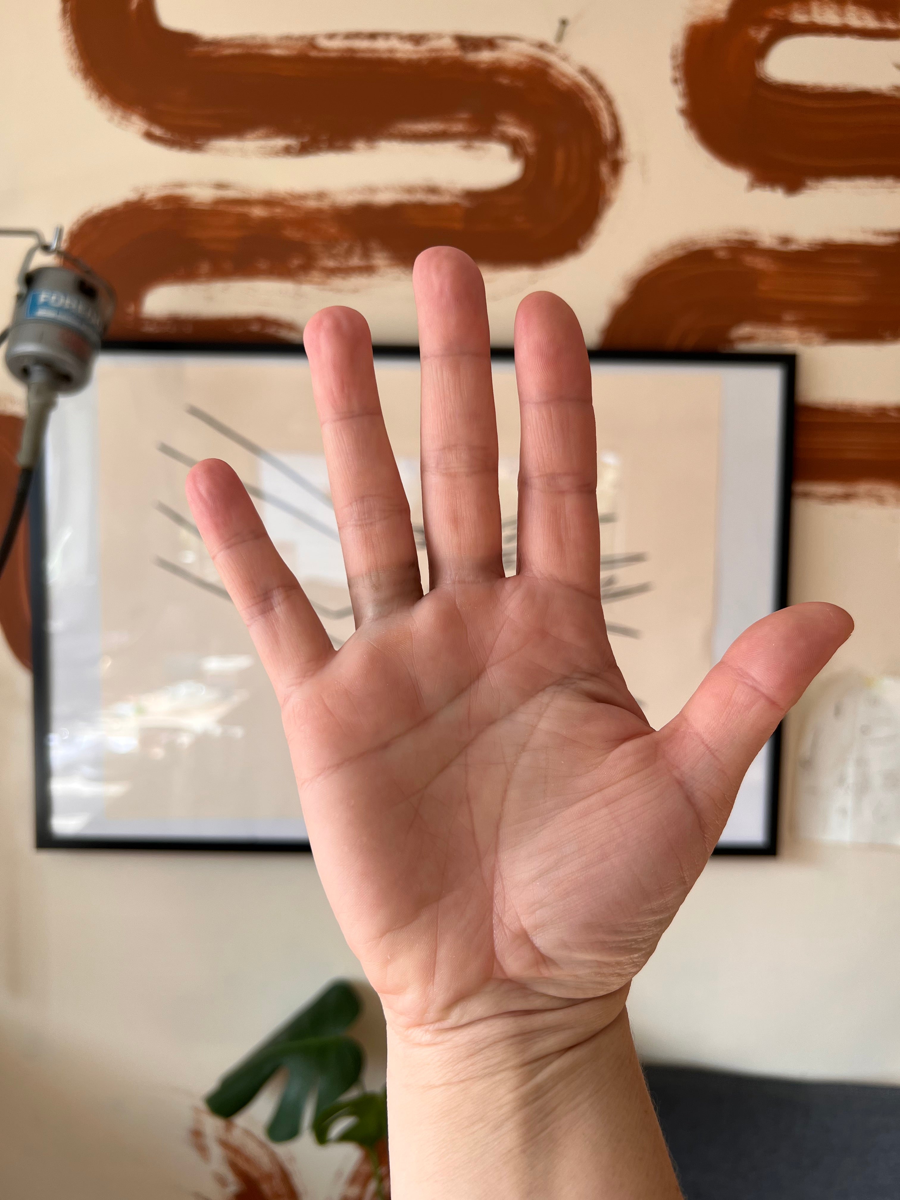 Hand with green marks on fingers from brass rings